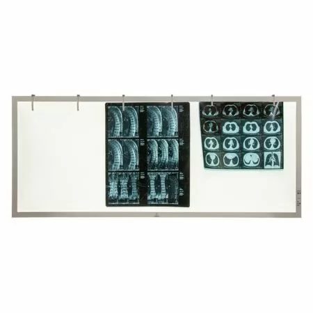 Негатоскоп TAGLER НСД-3 3-кадровый светодиодный